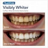 Plus White Speed Whitening Gel, 5-Minute Rapid Action Enamel-Safe Spot Treatment, 2 oz