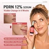 Salmon DNA PDRN 120,000ppm EGF Peptide Microneedling Serum with Hyaluronic Acid