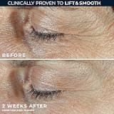 RoC Derm Correxion Dual Eye Cream with Advanced Retinol and Firming Peptides