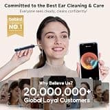 Bebird R1 Ultra Precision Ear Wax Removal Camera with Smart Tweezers