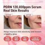 Salmon DNA PDRN 120,000 ppm EGF Peptide Intensive Microneedling Serum for Mature Skin