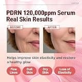 Salmon DNA PDRN 120,000ppm EGF Peptide Microneedling Serum with Hyaluronic Acid